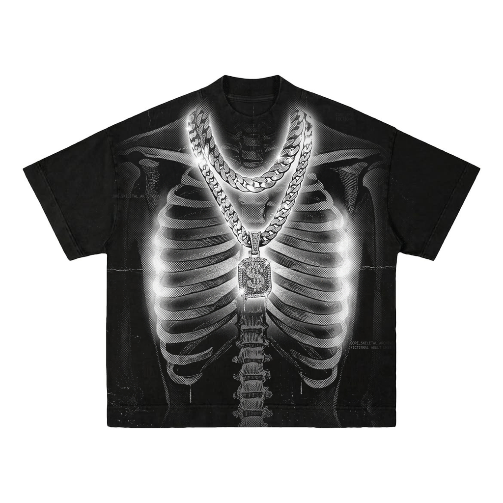 X-Ray