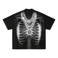 X-Ray