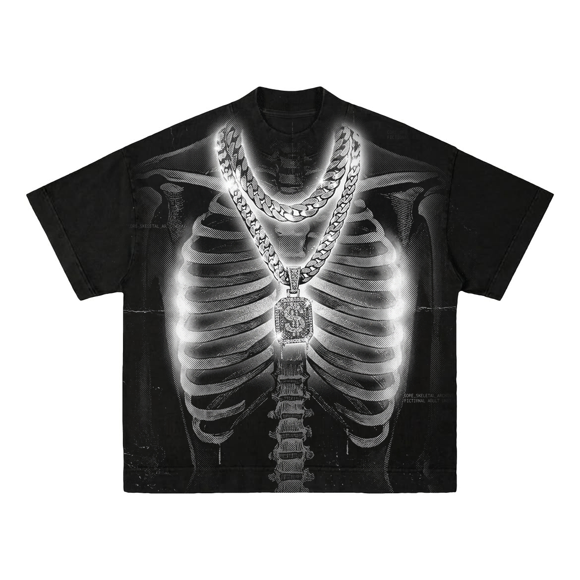 X-Ray